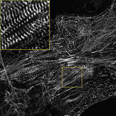 Cell line media